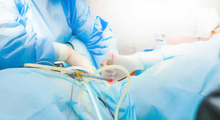 Laparoscopic radical hysterectomy