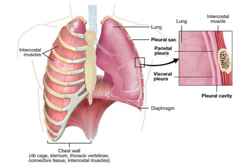 chest wall cancer doctor in delhi