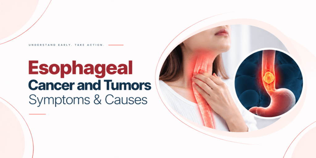 Esophageal Cancer and Tumors Symptoms & Causes