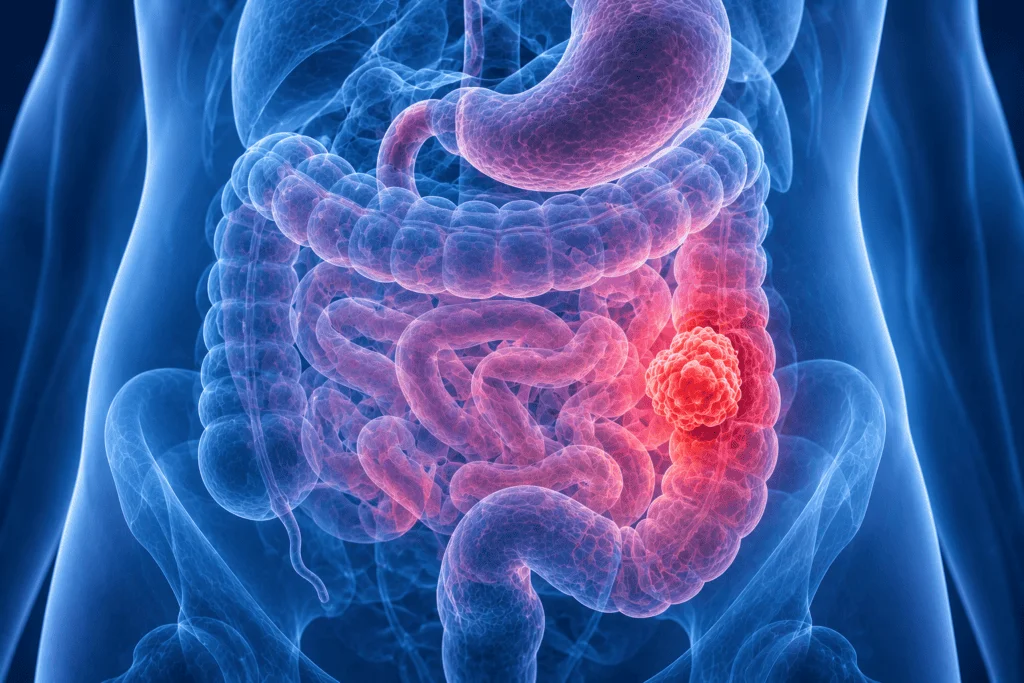 Gastrointestinal Cancer Surgery