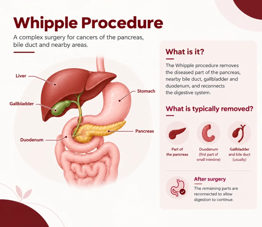 What is a Whipple Procedure?